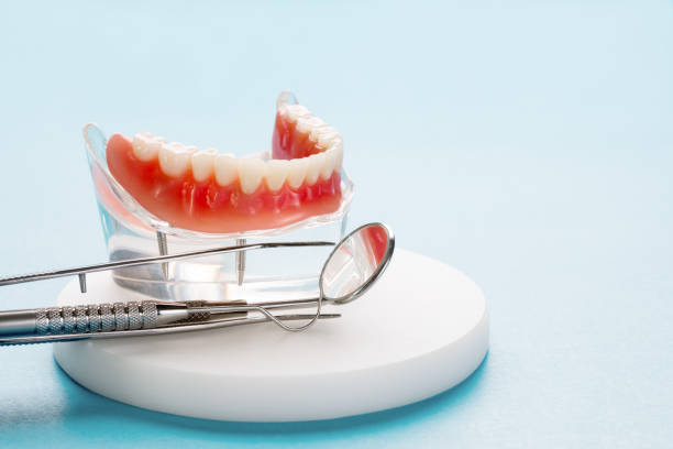 Dental Inlays and Onlays in Castaic, CA